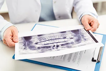 dr holding x-ray image